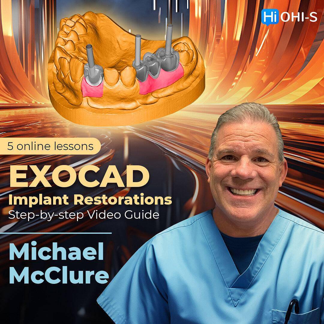 EXOCAD Implant Restorations: Step-by-step Video Guide 2023