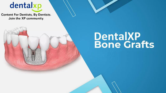 DentalXP - Bone Grafts
