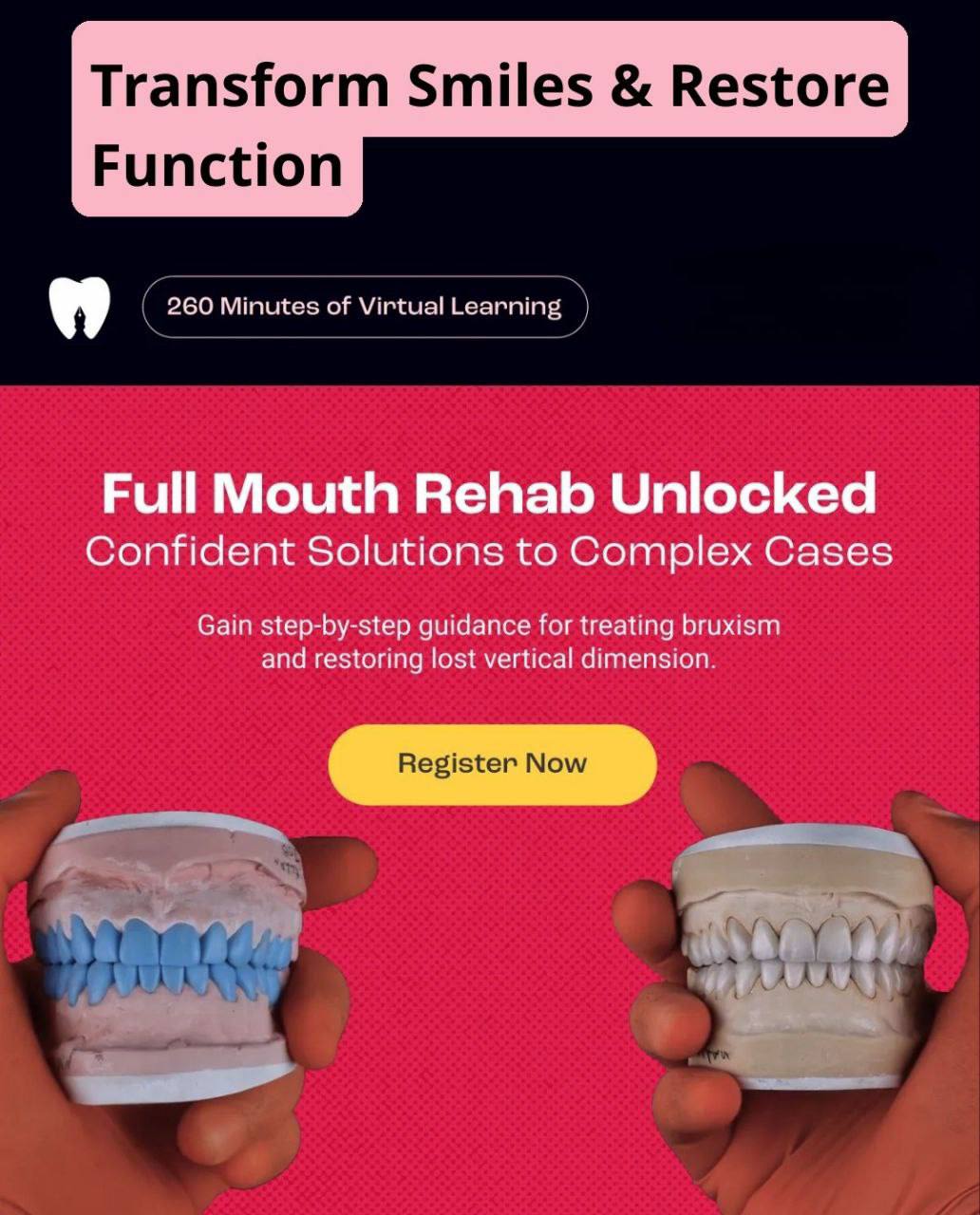 Full Mouth Rehab Unlocked - Confident Solution to Complex Cases (Moez Khakiani)