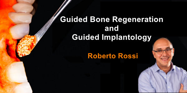 Guided regeneration & Guided Implantology