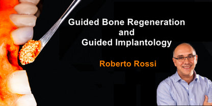 Guided regeneration & Guided Implantology