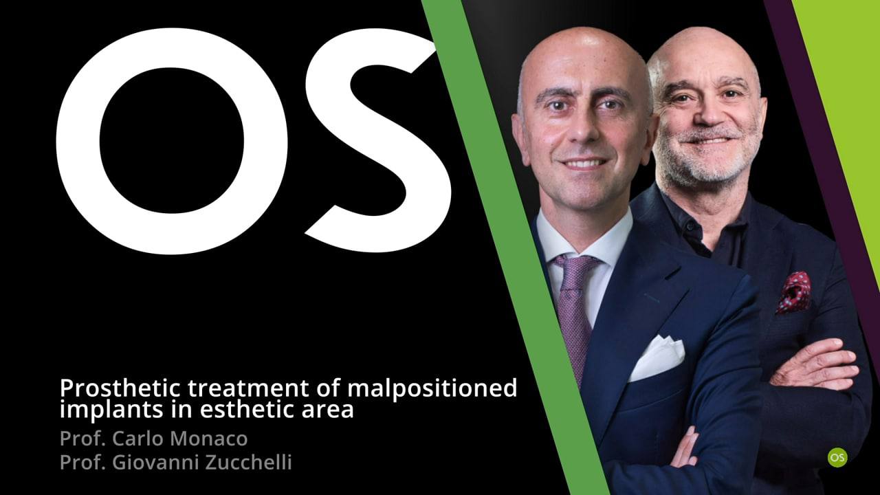 Treatment of malpositioned implants in the esthetic zone