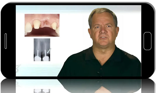 Spear-RIDGE, PONTICS & PAPILLA ESTHETIC STRATEGIES