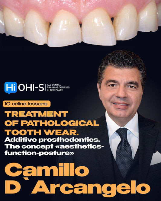 Treatment of pathological tooth wear:  Additive prosthodontics. The concept «Aesthetics-Function-Posture» - Camillo D`Arcangelo