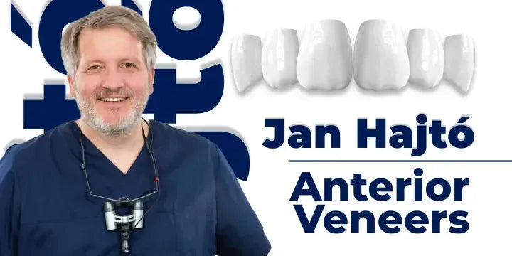 Anterior veneers: digital manufacturing protocols for functional and aesthetic restorations