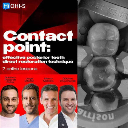 Contact Point: Effective Posterior Teeth Direct Restoration Technique