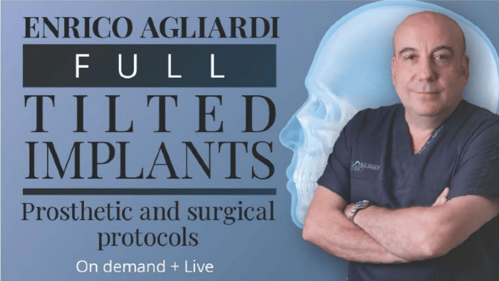 Full tilted implants: Prosthetic and Surgical protocols