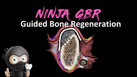 Guided Bone Regeneration - Ninja GBR