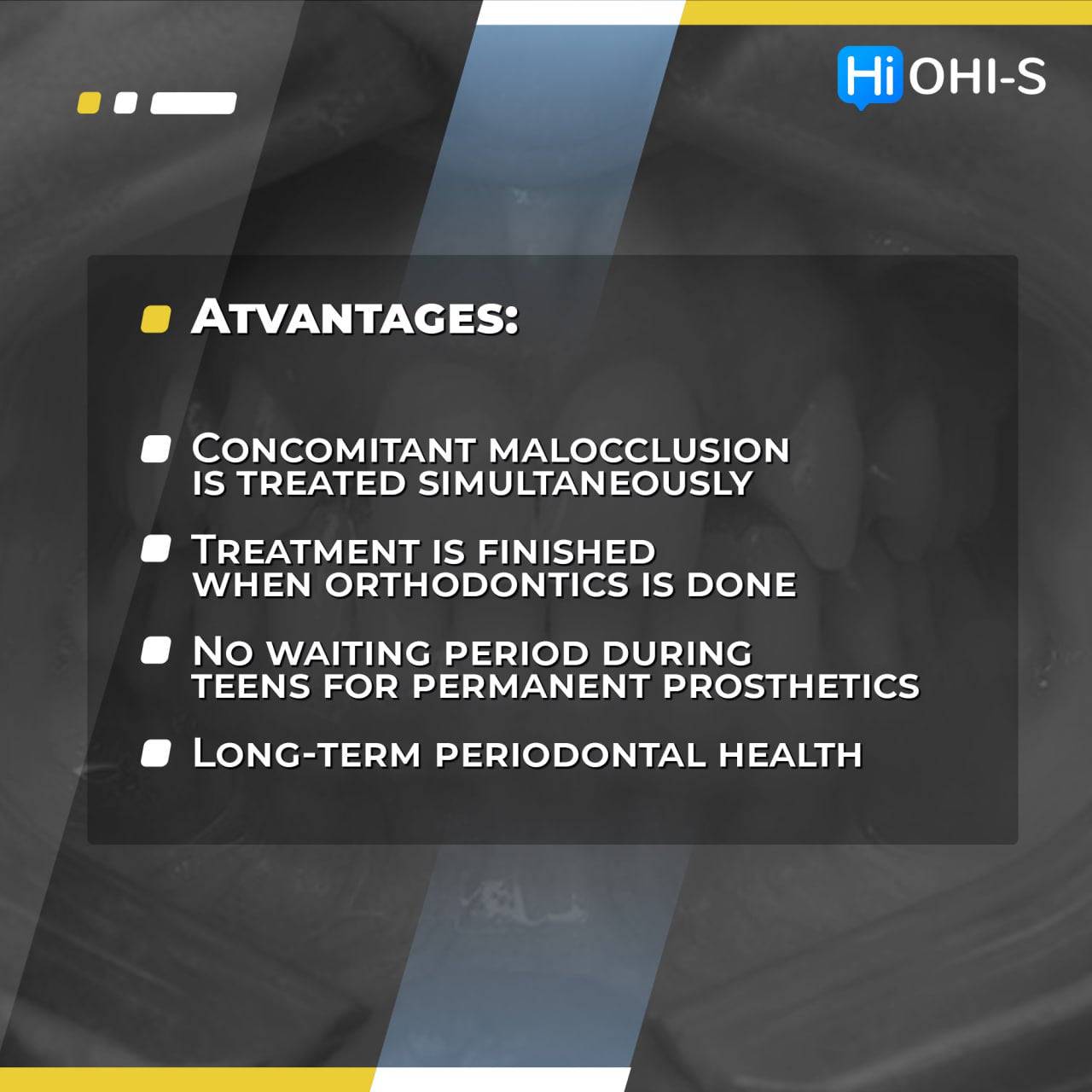 Missing Maxillary Lateral Incisors: Space Closure in all Malocclusions vs Implants and Prosthetic Replacement