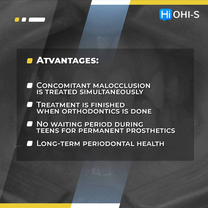 Missing Maxillary Lateral Incisors: Space Closure in all Malocclusions vs Implants and Prosthetic Replacement