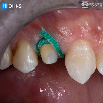 Vertical Preparation Protocols The Complete Guide in 24 Lessons from Tomorrow Tooth