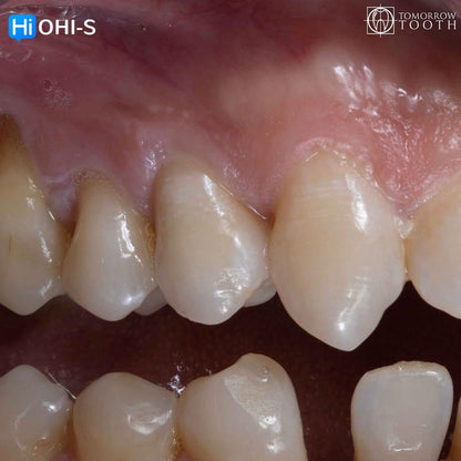 Vertical Preparation Protocols The Complete Guide in 24 Lessons from Tomorrow Tooth